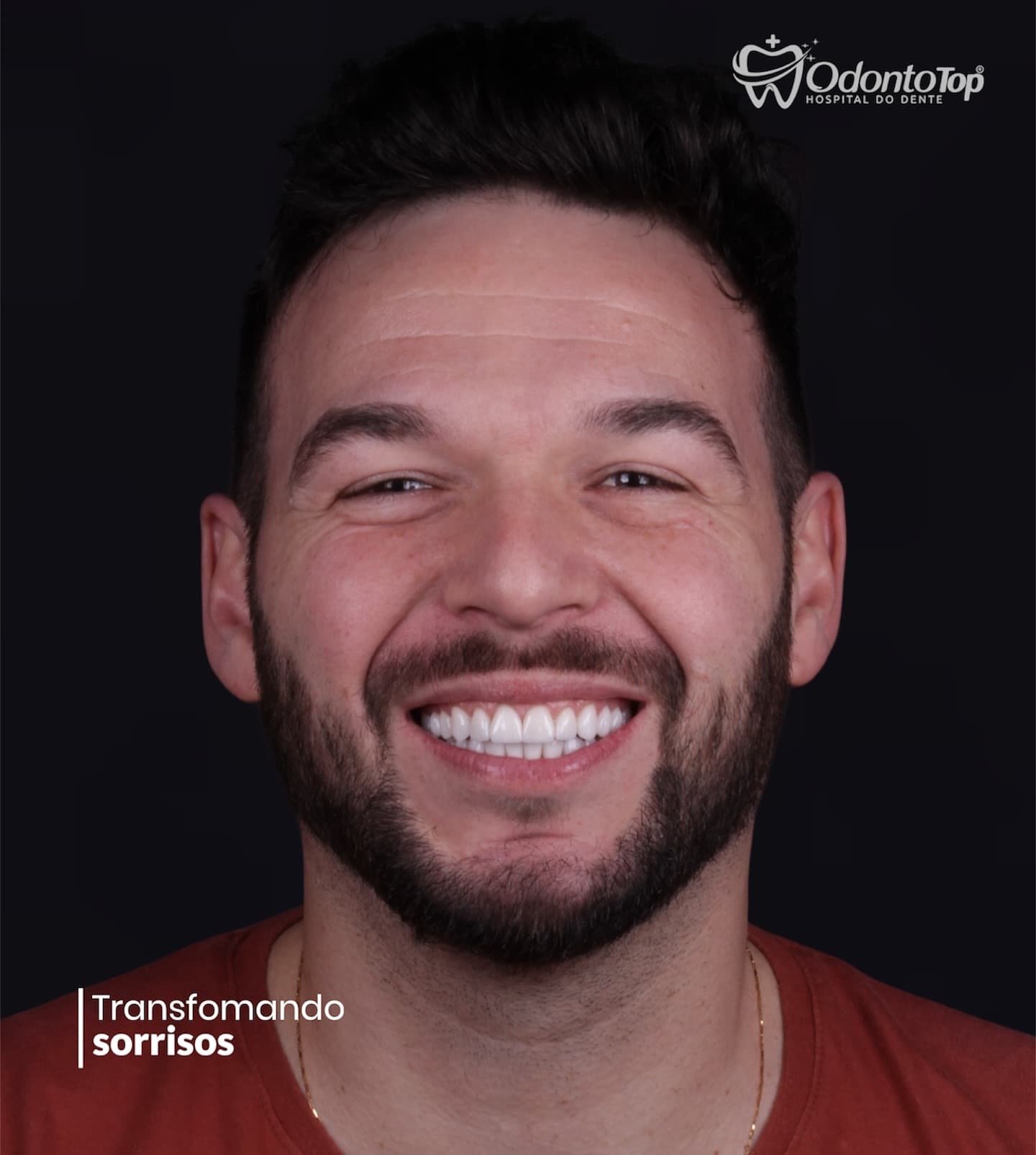 Depois — Resultado real