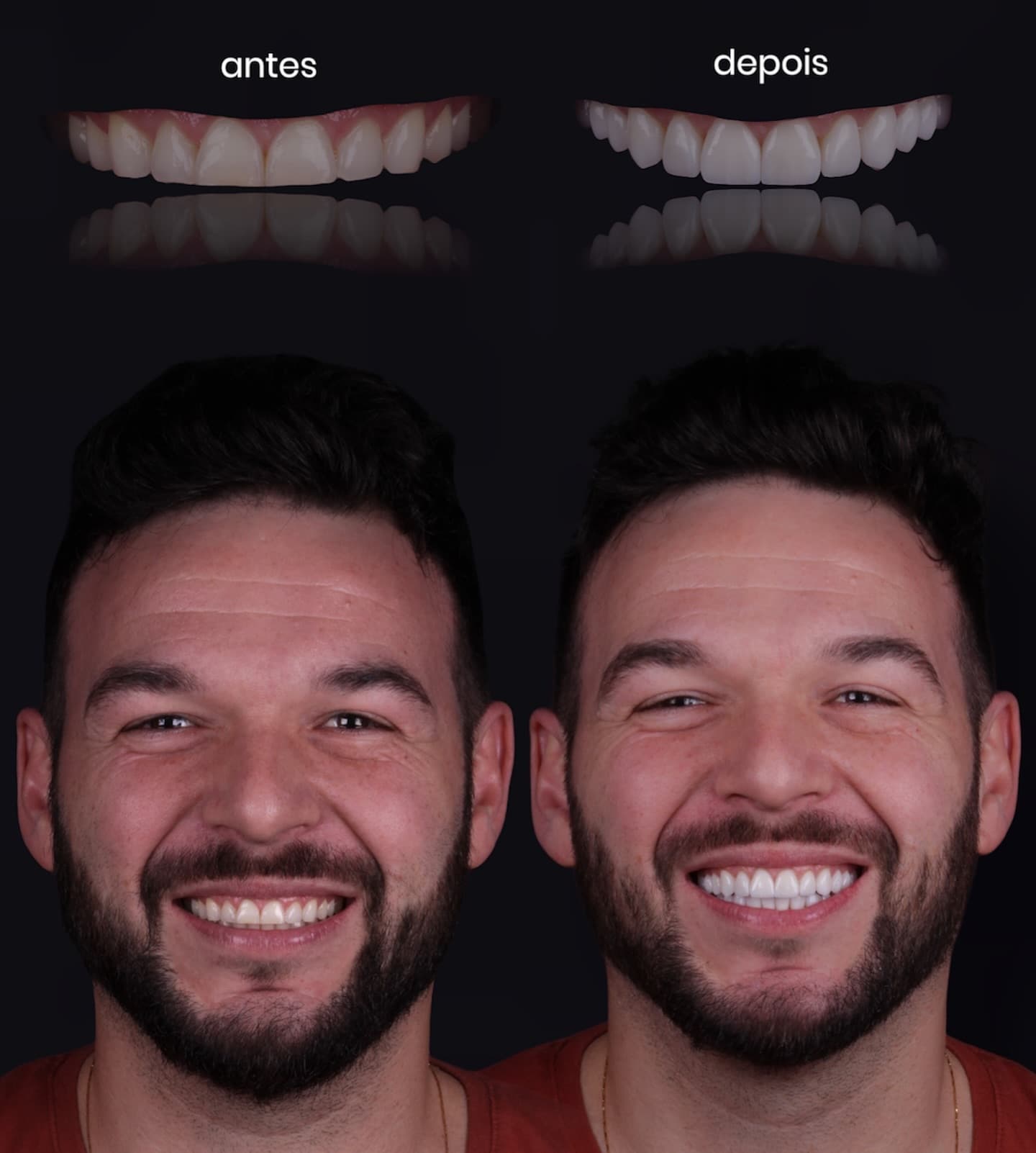 Depois — Resultado real