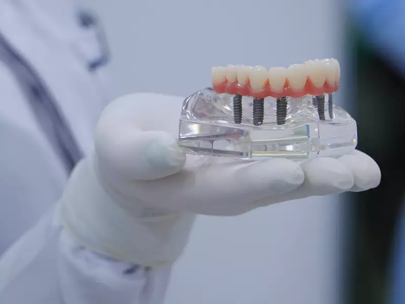 Modelo de implante odontológico sendo mostrado por um profissional com luvas.