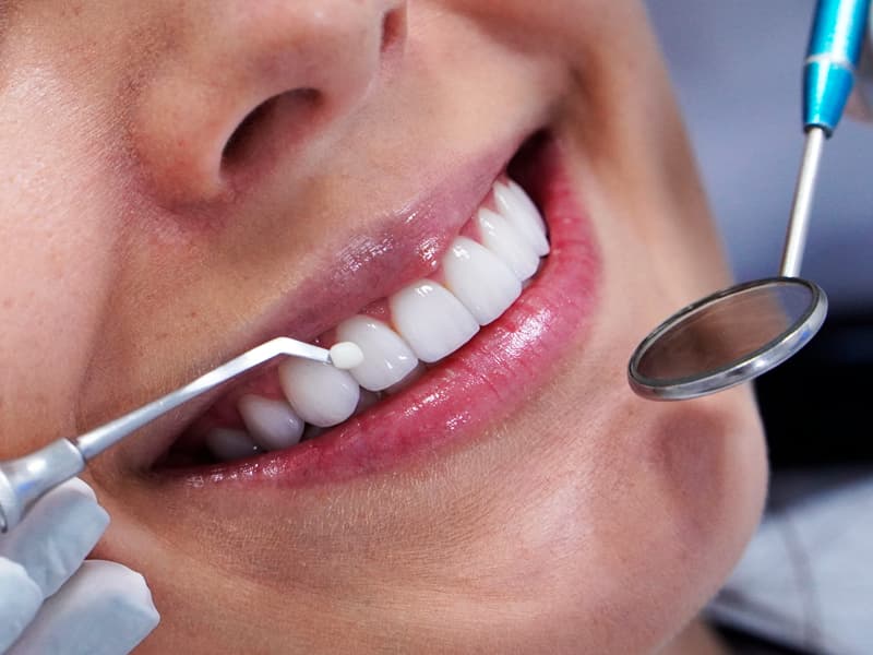 Uma close-up de dentes sendo tratados, com ferramentas visíveis.